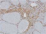 3176B | Control Slides:Immunopathology; CD34